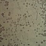 Thumbnail of before 01 1 scaled